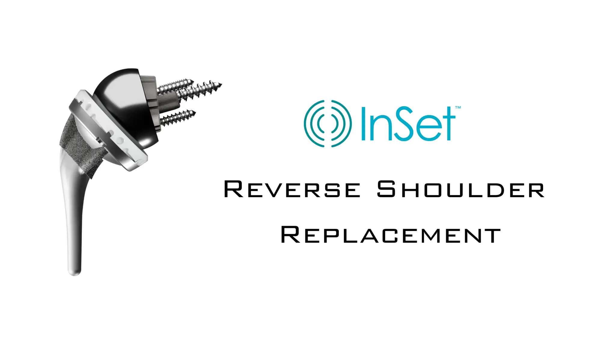 InSet™ Reverse Shoulder Implant