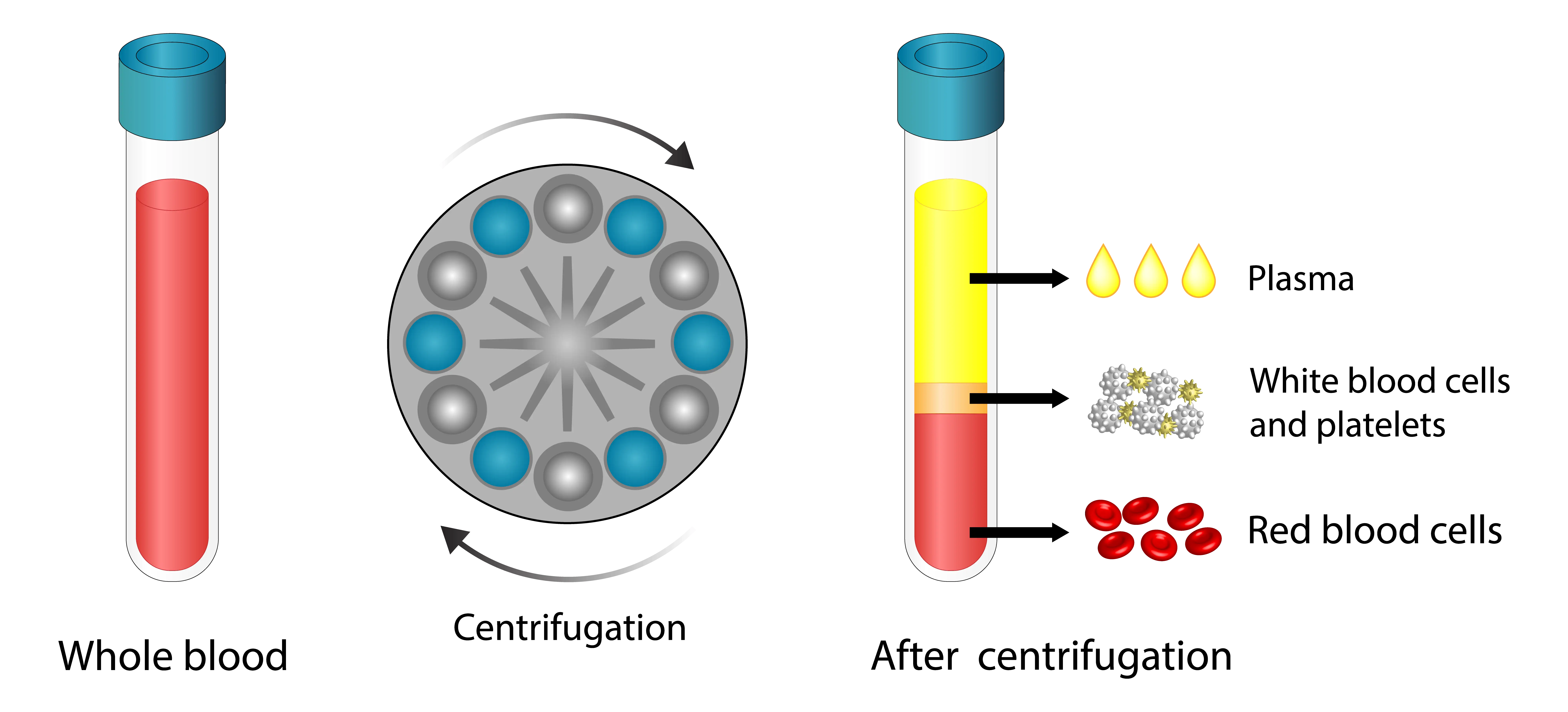 PRP for Elbow Graphic