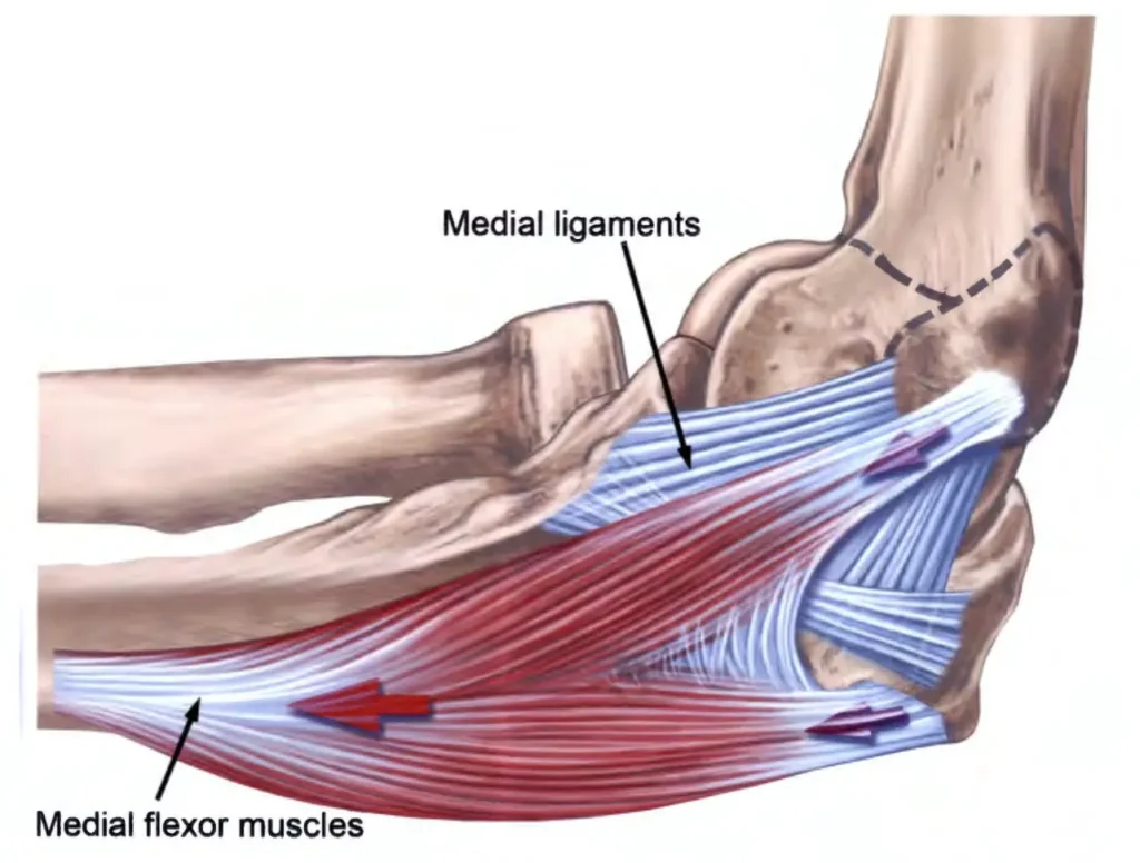 Medial ligaments golfer's elbow