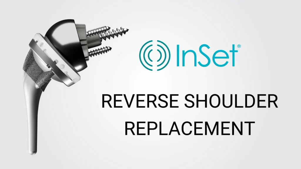 reverse shoulder replacement tool from InSet