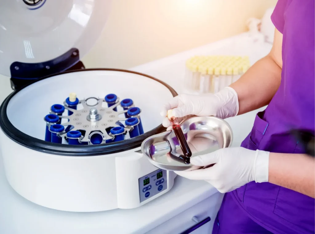 Surgeon preparing PRP centrifugation for patient.