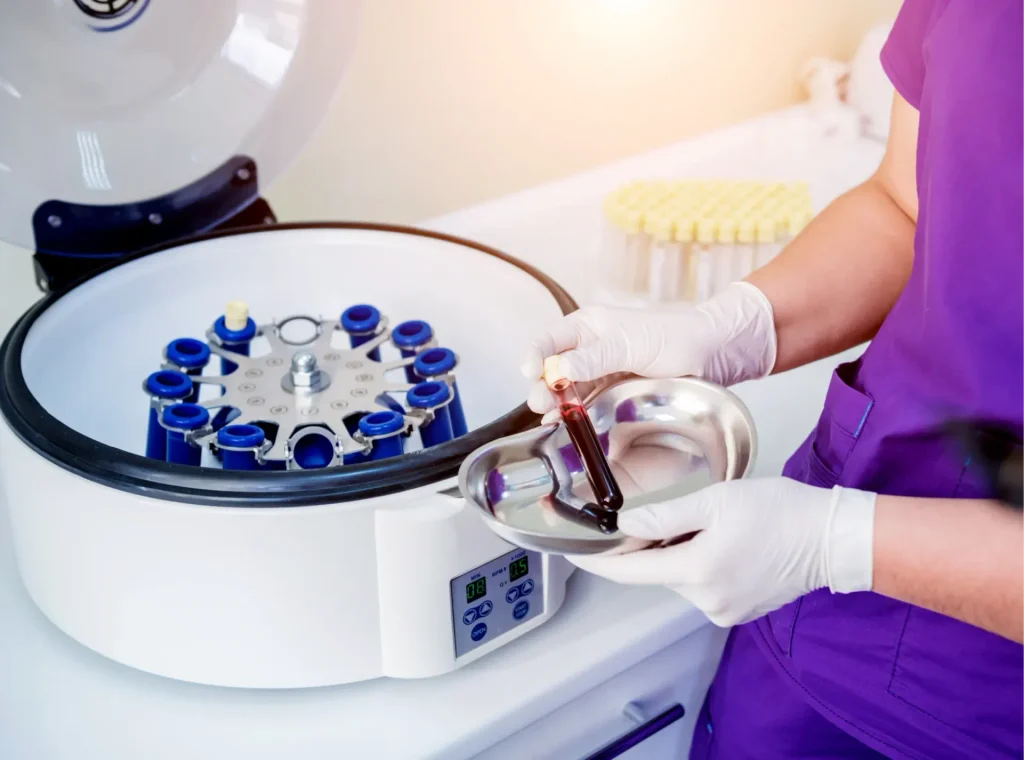 PRP process image